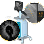 Philips fecha acordo para comprar SpectraWAVE e ampliar uso de IA em intervenções coronarianas